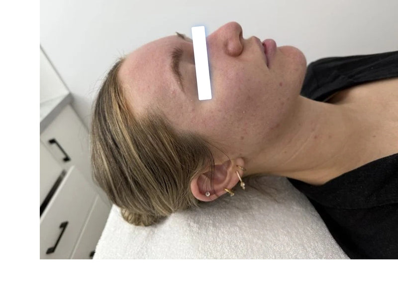 Before treatment