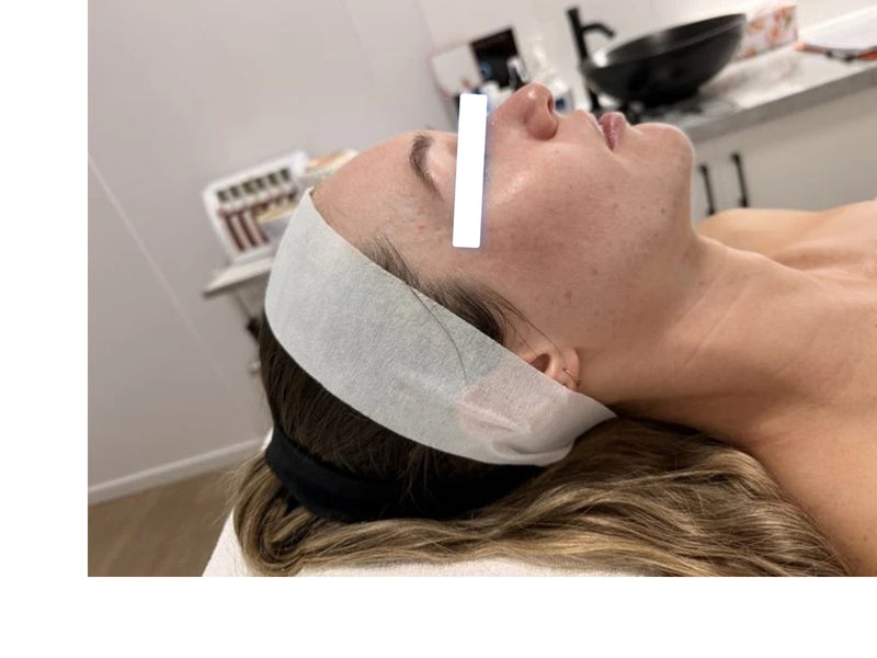 After treatment