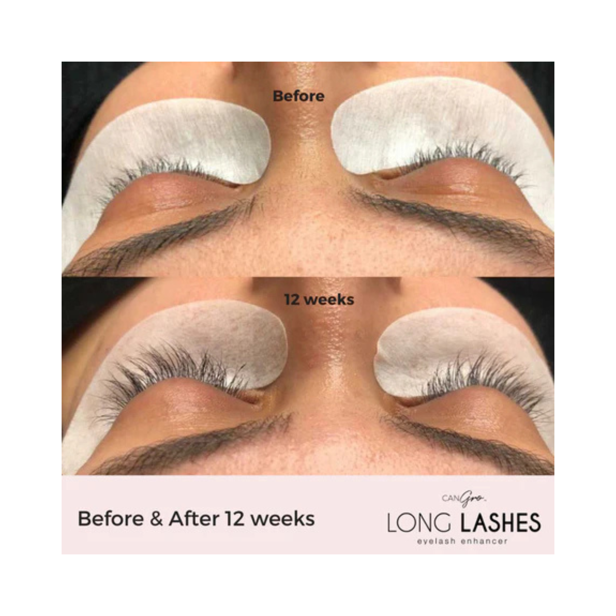 CanGro Eyelash Enhancer | Lash Growth Serum