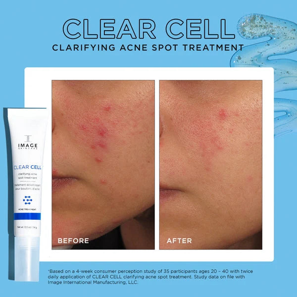 CLEAR CELL clarifying salicylic blemish gel