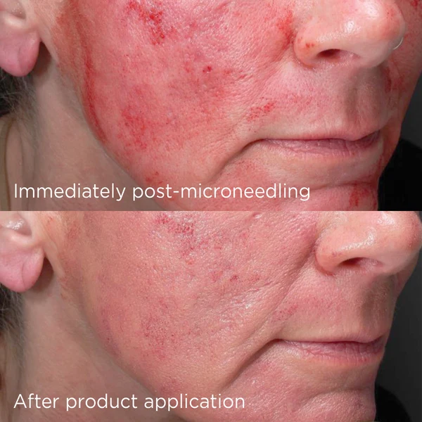 IMAGE - DAILY PREVENTION advanced smartblend mineral moisturizer