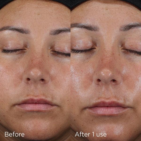 IMAGE -DAILY PREVENTION ultra defense moisturizer